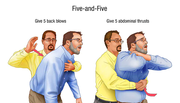 five and five choking